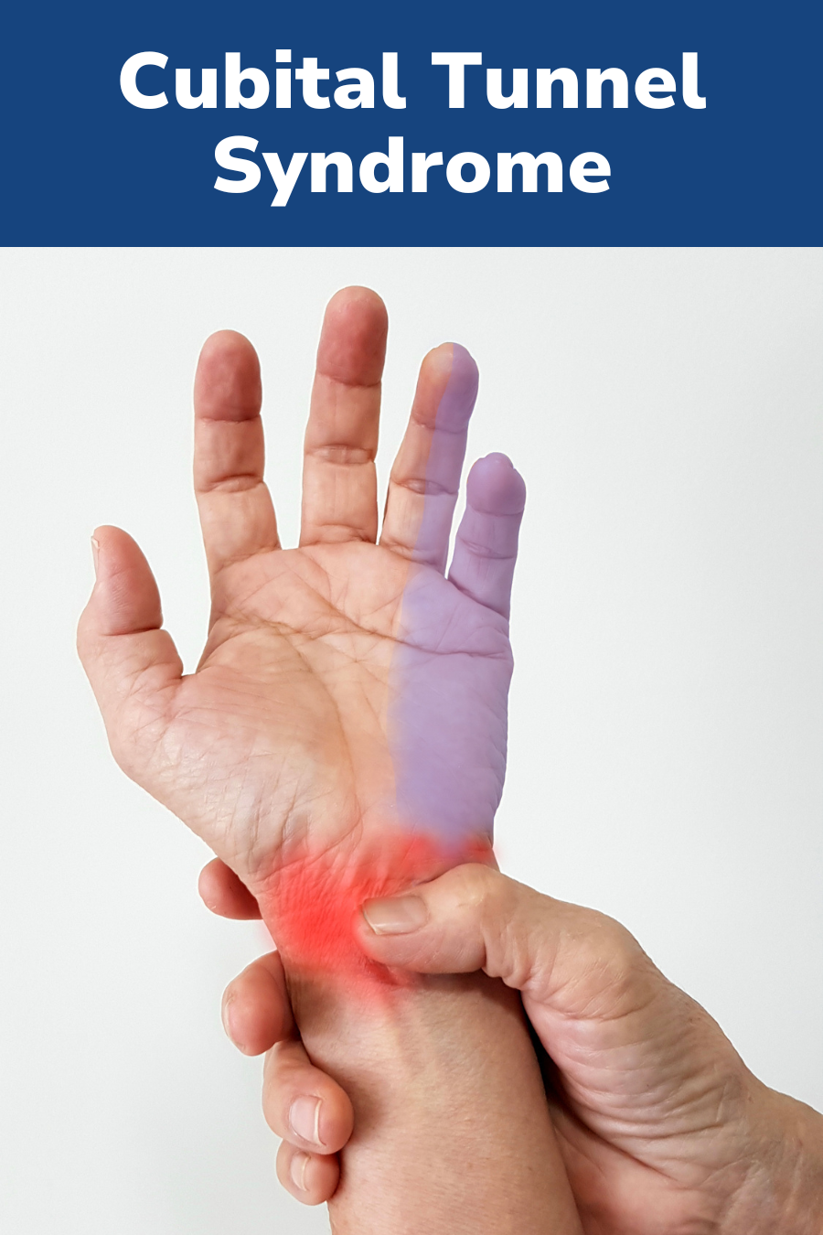 Carpal Tunnel Vs Cubital Tunnel Syndrome What S The Difference